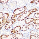 Immunohistochemistry - Anti-ANGPTL3 Antibody [ARC1214] (A307333) - Antibodies.com