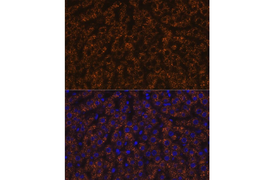 Immunofluorescence - Anti-ANGPTL3 Antibody [ARC1214] (A307333) - Antibodies.com