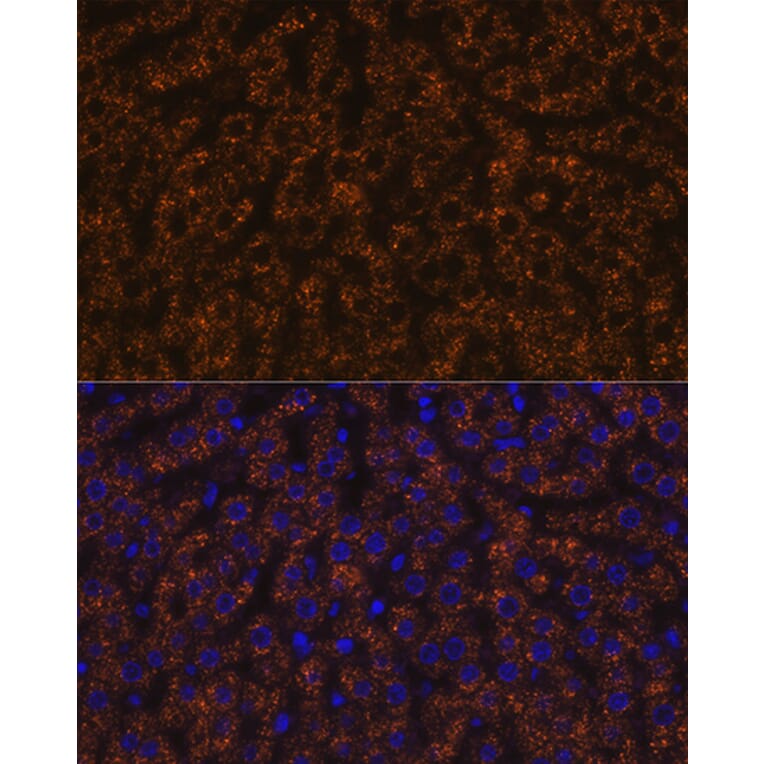 Immunofluorescence - Anti-ANGPTL3 Antibody [ARC1214] (A307333) - Antibodies.com