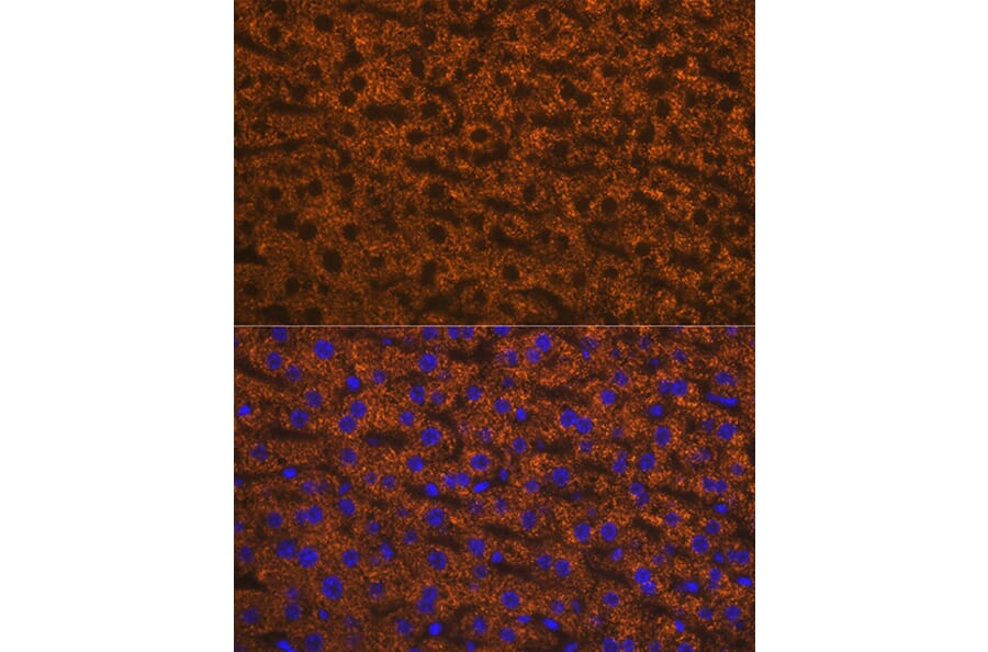 Immunofluorescence - Anti-ANGPTL3 Antibody [ARC1214] (A307333) - Antibodies.com