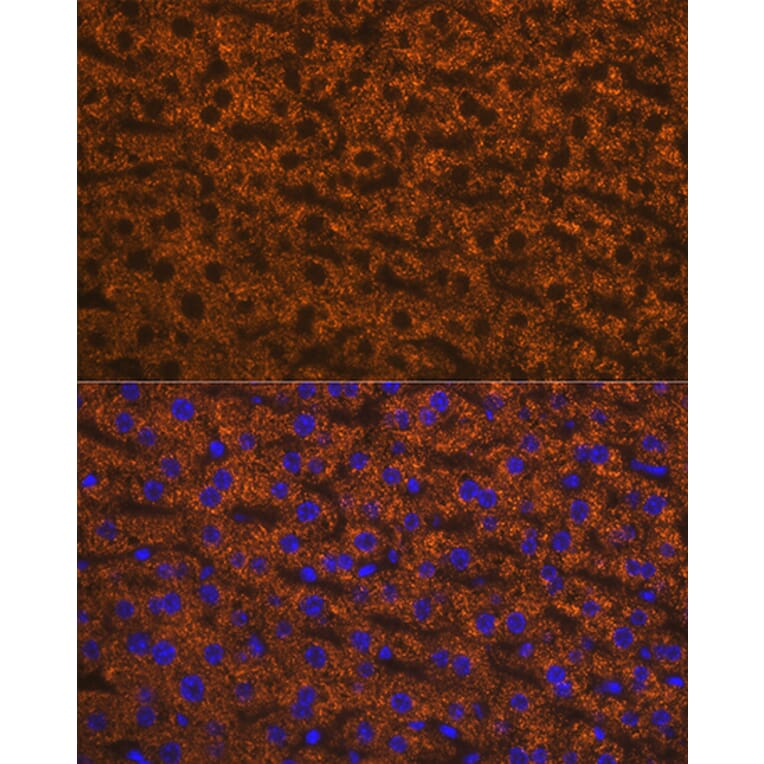 Immunofluorescence - Anti-ANGPTL3 Antibody [ARC1214] (A307333) - Antibodies.com