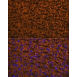 Immunofluorescence - Anti-ANGPTL3 Antibody [ARC1214] (A307333) - Antibodies.com