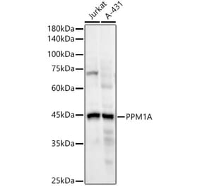 Western Blot - Anti-PPM1A Antibody [ARC55164] (A307336) - Antibodies.com