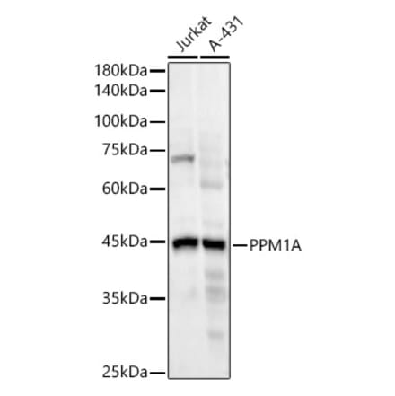 Western Blot - Anti-PPM1A Antibody [ARC55164] (A307336) - Antibodies.com