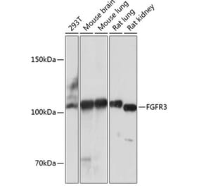 Western Blot - Anti-FGFR3 Antibody [ARC0398] (A307337) - Antibodies.com