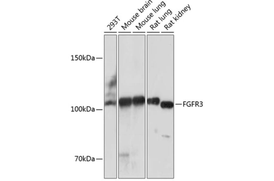 Western Blot - Anti-FGFR3 Antibody [ARC0398] (A307337) - Antibodies.com