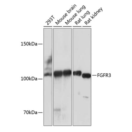 Western Blot - Anti-FGFR3 Antibody [ARC0398] (A307337) - Antibodies.com
