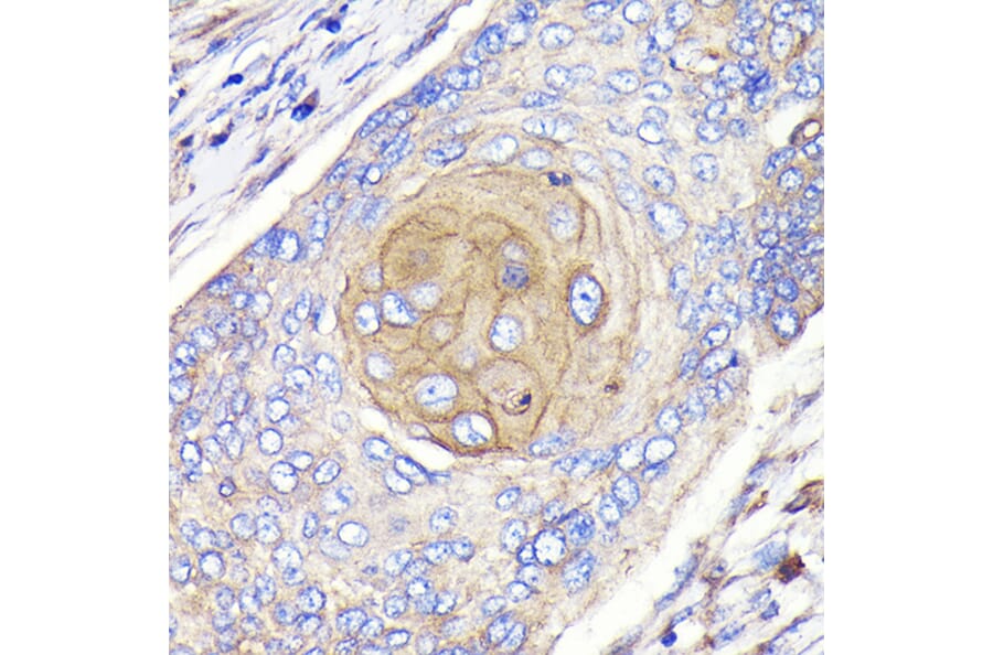 Immunohistochemistry - Anti-FGFR3 Antibody [ARC0398] (A307337) - Antibodies.com