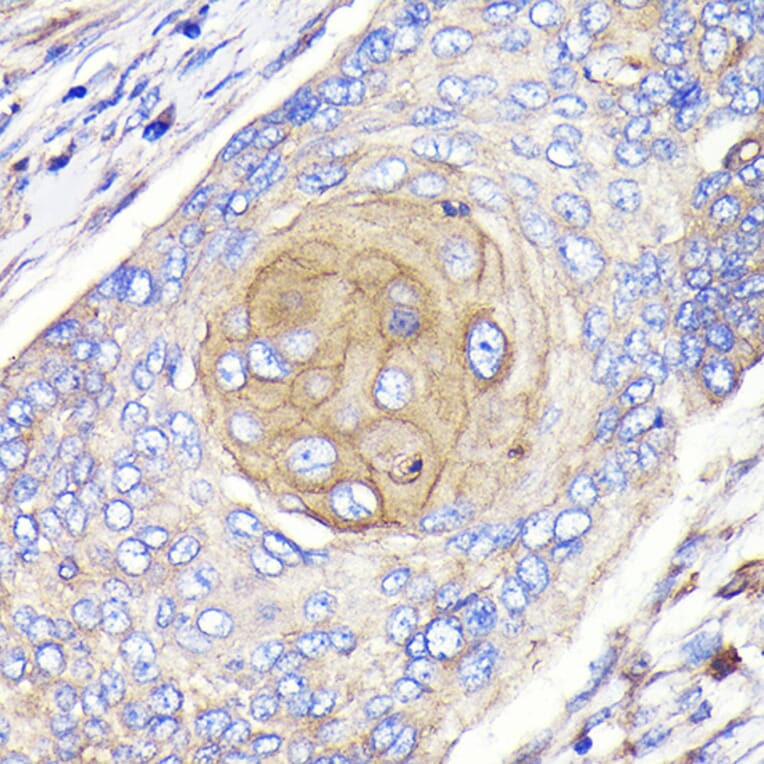 Immunohistochemistry - Anti-FGFR3 Antibody [ARC0398] (A307337) - Antibodies.com