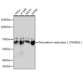 Western Blot - Anti-TXNRD1 Antibody [ARC1106] (A307341) - Antibodies.com