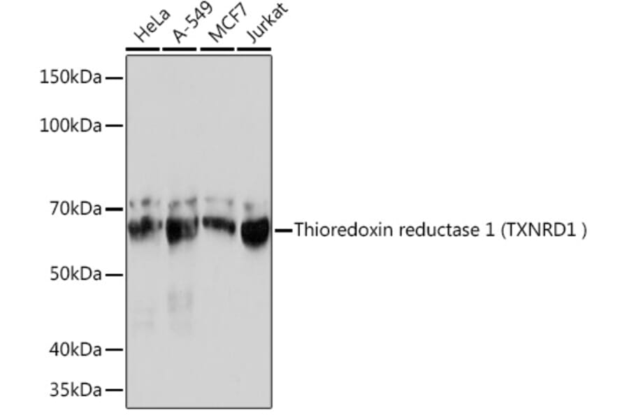 Western Blot - Anti-TXNRD1 Antibody [ARC1106] (A307341) - Antibodies.com