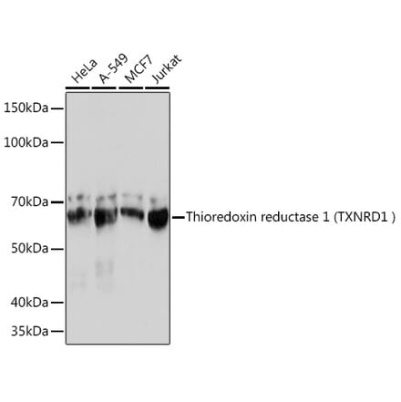 Western Blot - Anti-TXNRD1 Antibody [ARC1106] (A307341) - Antibodies.com