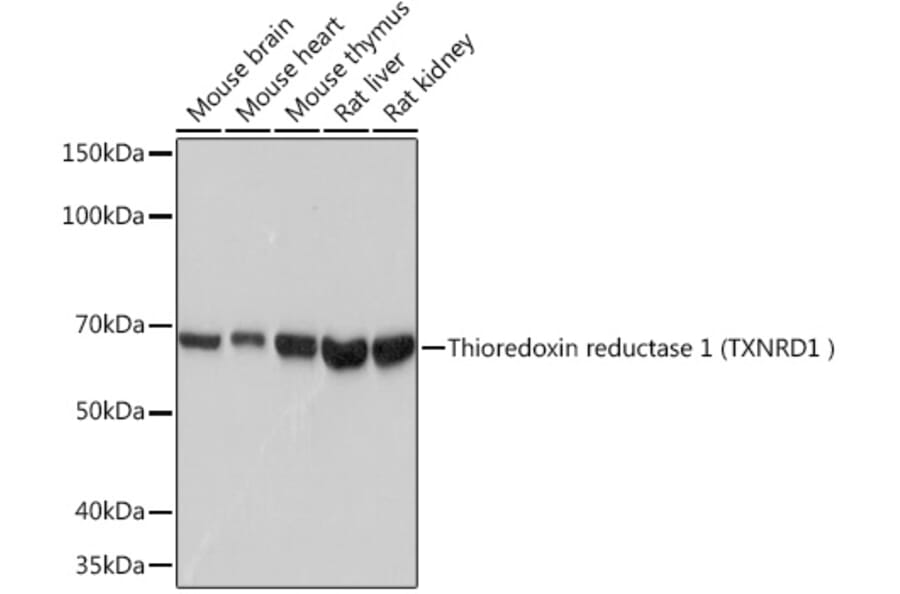 Western Blot - Anti-TXNRD1 Antibody [ARC1106] (A307341) - Antibodies.com