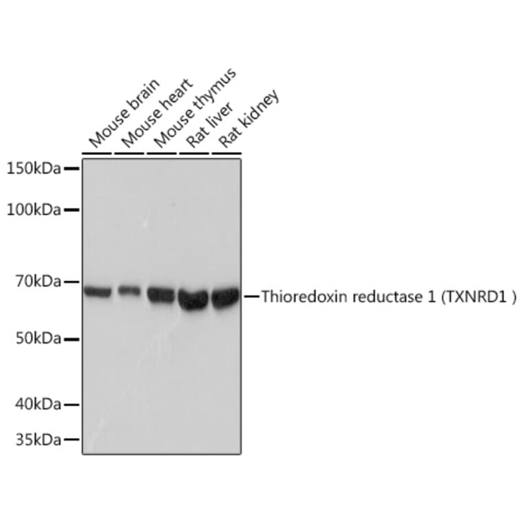 Western Blot - Anti-TXNRD1 Antibody [ARC1106] (A307341) - Antibodies.com