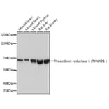 Western Blot - Anti-TXNRD1 Antibody [ARC1106] (A307341) - Antibodies.com