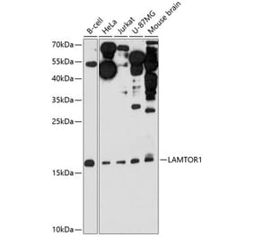 Western Blot - Anti-LAMTOR1 Antibody (A307342) - Antibodies.com