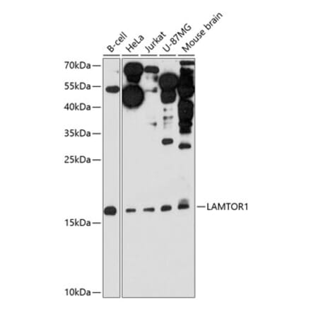 Western Blot - Anti-LAMTOR1 Antibody (A307342) - Antibodies.com