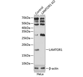 Western Blot - Anti-LAMTOR1 Antibody (A307343) - Antibodies.com