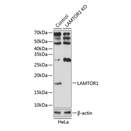 Western Blot - Anti-LAMTOR1 Antibody (A307343) - Antibodies.com