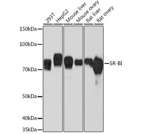 Western Blot - Anti-Scavenging Receptor SR-BI Antibody [ARC0334] (A307344) - Antibodies.com