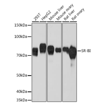 Western Blot - Anti-Scavenging Receptor SR-BI Antibody [ARC0334] (A307344) - Antibodies.com