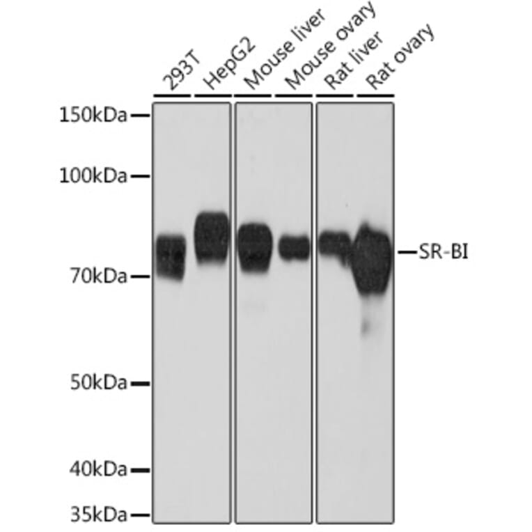 Western Blot - Anti-Scavenging Receptor SR-BI Antibody [ARC0334] (A307344) - Antibodies.com