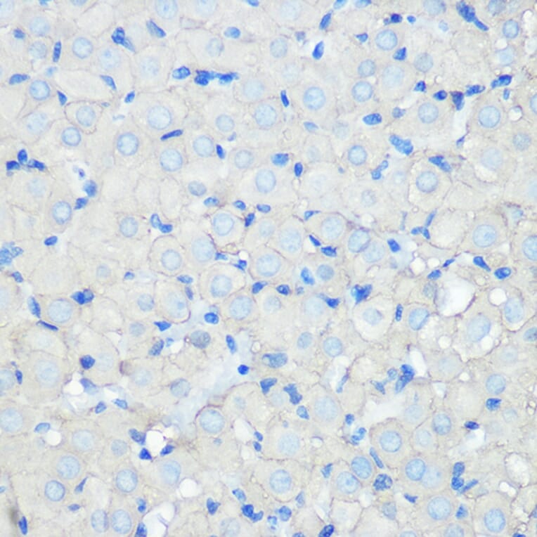 Immunohistochemistry - Anti-Scavenging Receptor SR-BI Antibody [ARC0334] (A307344) - Antibodies.com