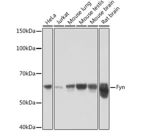 Western Blot - Anti-Fyn Antibody [ARC1459] (A307345) - Antibodies.com
