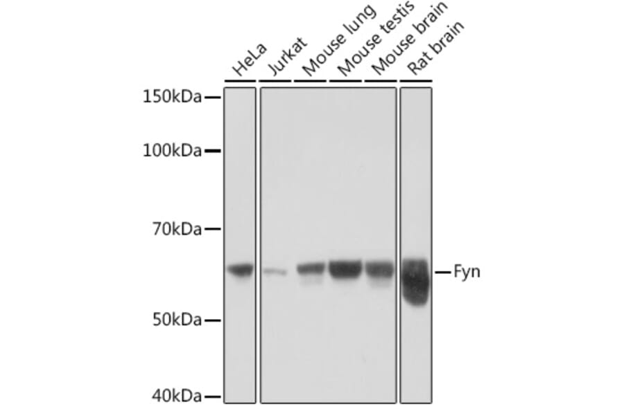 Western Blot - Anti-Fyn Antibody [ARC1459] (A307345) - Antibodies.com