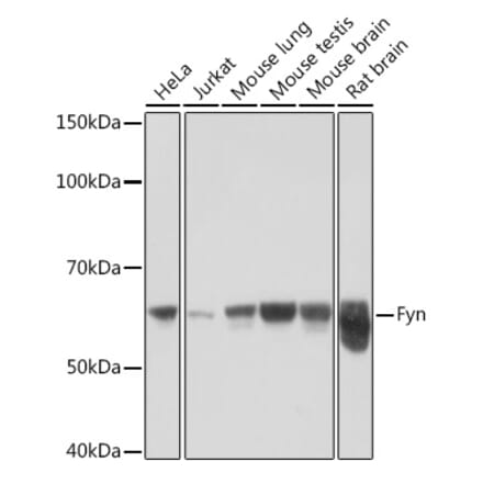Western Blot - Anti-Fyn Antibody [ARC1459] (A307345) - Antibodies.com