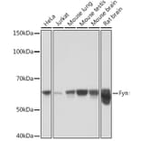 Western Blot - Anti-Fyn Antibody [ARC1459] (A307345) - Antibodies.com