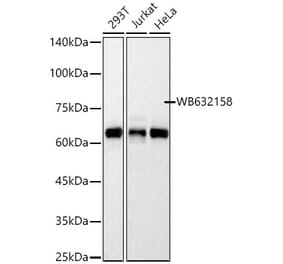Western Blot - Anti-RNF8 Antibody [ARC58373] (A307349) - Antibodies.com