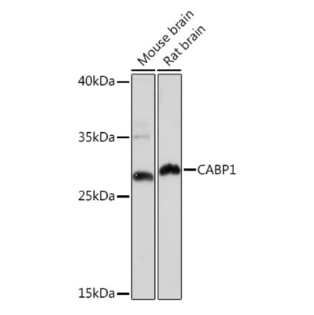 Western Blot - Anti-CABP Antibody (A307350) - Antibodies.com