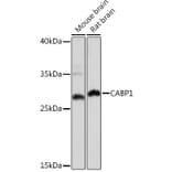 Western Blot - Anti-CABP Antibody (A307350) - Antibodies.com