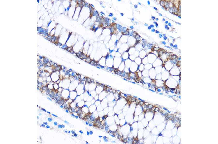Immunohistochemistry - Anti-CABP Antibody (A307350) - Antibodies.com