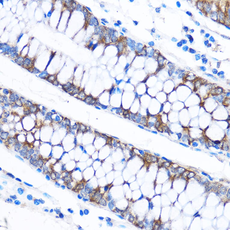 Immunohistochemistry - Anti-CABP Antibody (A307350) - Antibodies.com