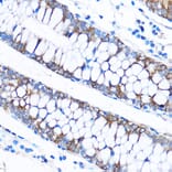 Immunohistochemistry - Anti-CABP Antibody (A307350) - Antibodies.com