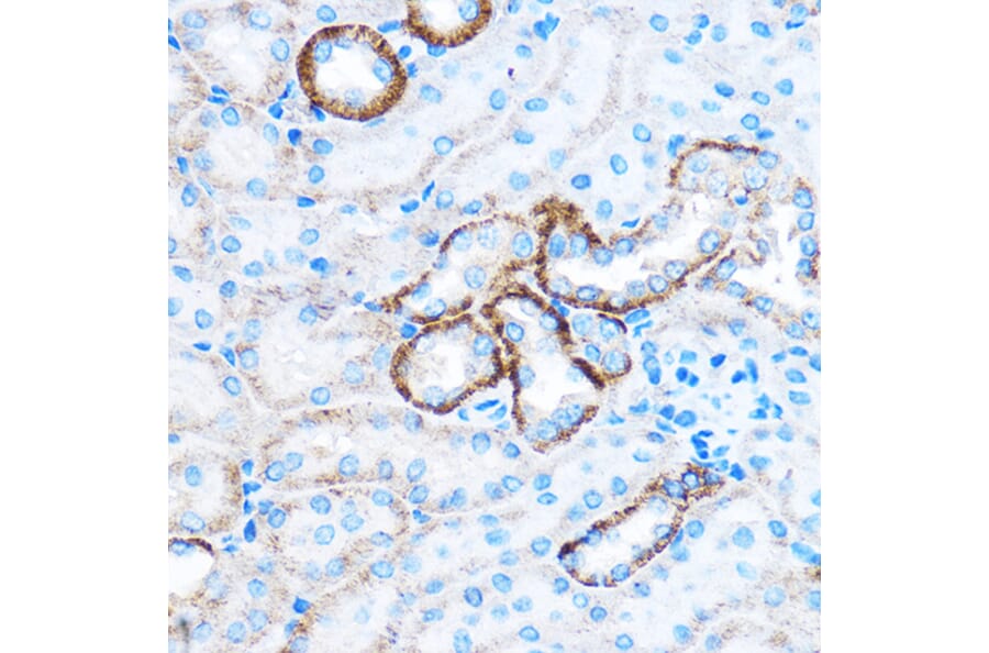 Immunohistochemistry - Anti-CABP Antibody (A307350) - Antibodies.com