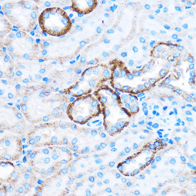 Immunohistochemistry - Anti-CABP Antibody (A307350) - Antibodies.com