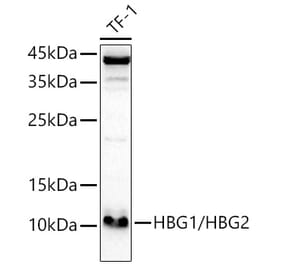 Western Blot - Anti-fetal hemoglobin Antibody (A307353) - Antibodies.com