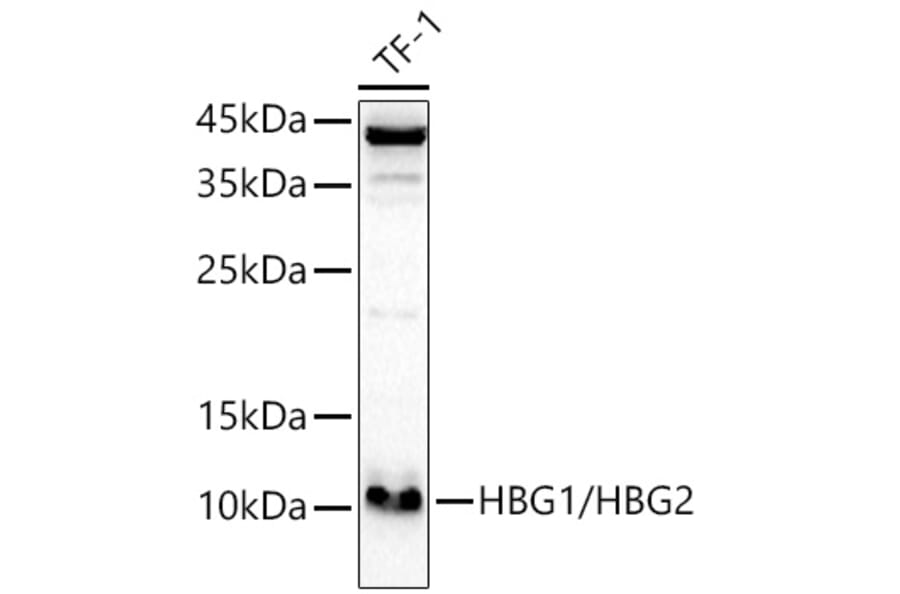 Western Blot - Anti-Fetal Hemoglobin Antibody (A307353) - Antibodies.com