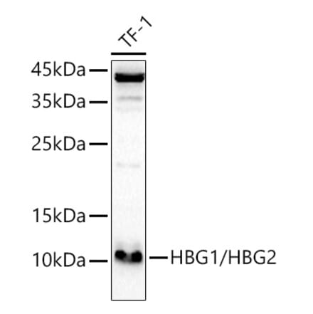 Western Blot - Anti-fetal hemoglobin Antibody (A307353) - Antibodies.com