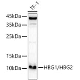 Western Blot - Anti-fetal hemoglobin Antibody (A307353) - Antibodies.com