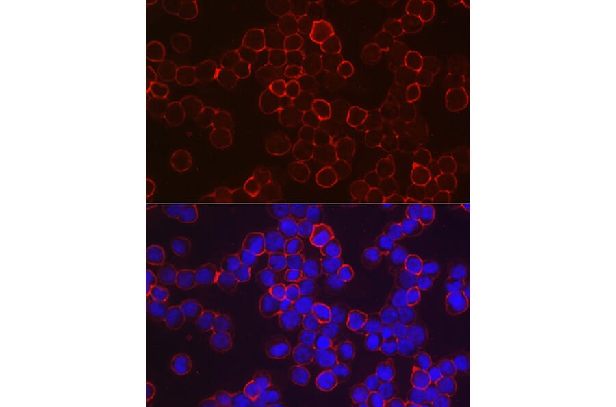 Immunofluorescence - Anti-Fetal Hemoglobin Antibody (A307353) - Antibodies.com