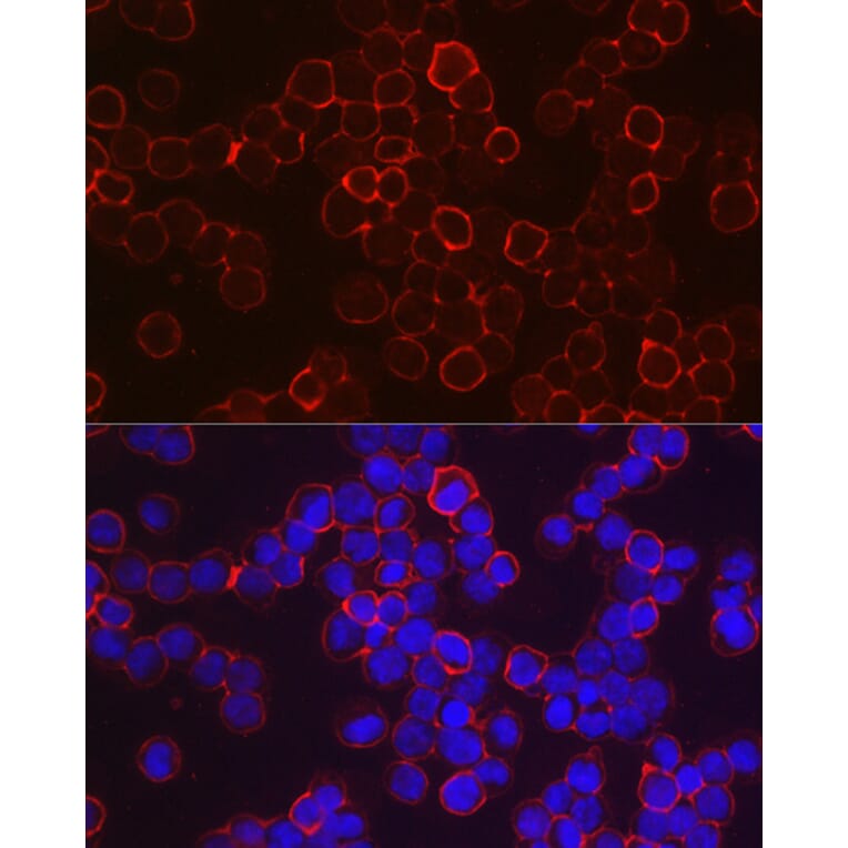 Immunofluorescence - Anti-fetal hemoglobin Antibody (A307353) - Antibodies.com