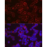 Immunofluorescence - Anti-fetal hemoglobin Antibody (A307353) - Antibodies.com