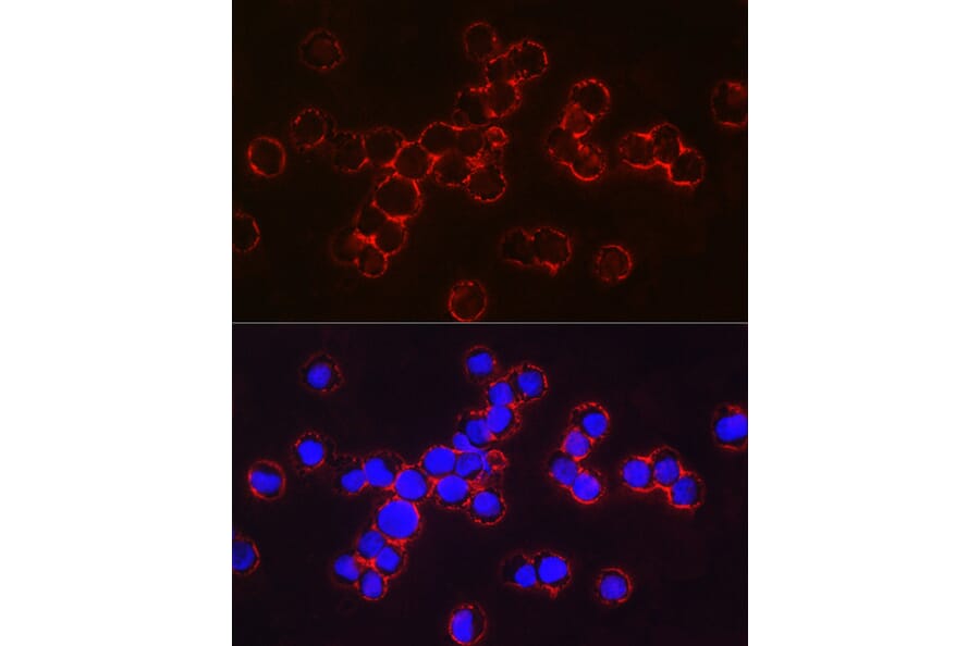 Immunofluorescence - Anti-Fetal Hemoglobin Antibody (A307353) - Antibodies.com