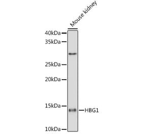 Western Blot - Anti-fetal hemoglobin Antibody [ARC1838] (A307354) - Antibodies.com