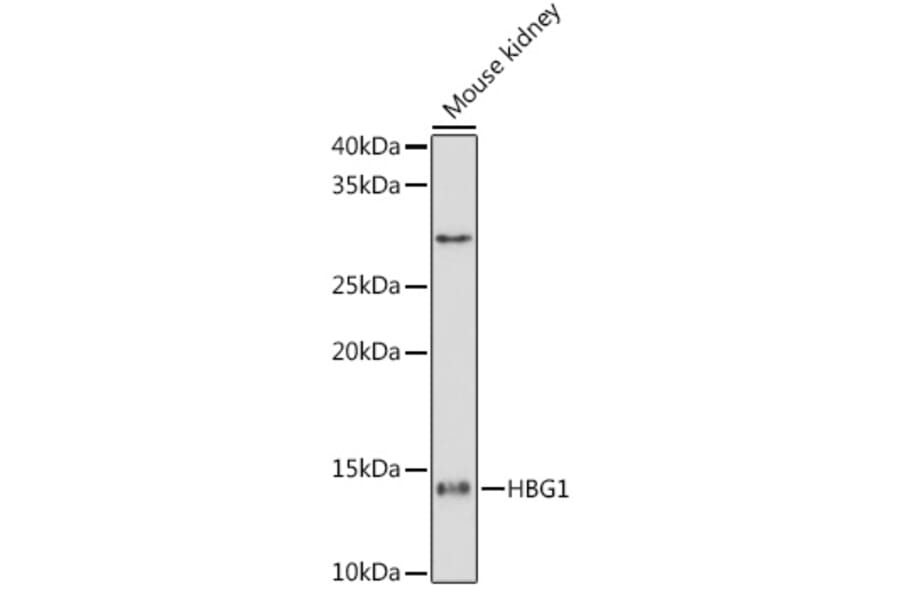 Western Blot - Anti-Fetal Hemoglobin Antibody [ARC1838] (A307354) - Antibodies.com