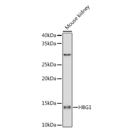 Western Blot - Anti-fetal hemoglobin Antibody [ARC1838] (A307354) - Antibodies.com